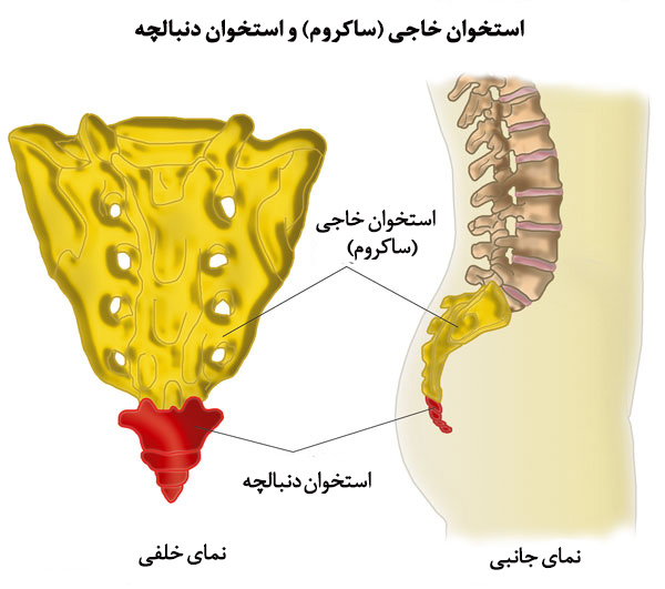 درد دنبالچه 3