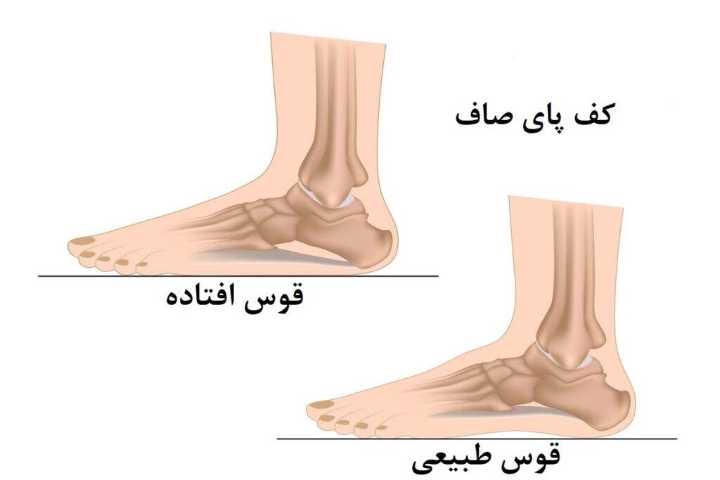 کف پای صاف 3