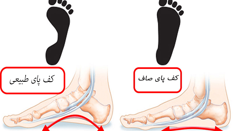 کف پای صاف 4
